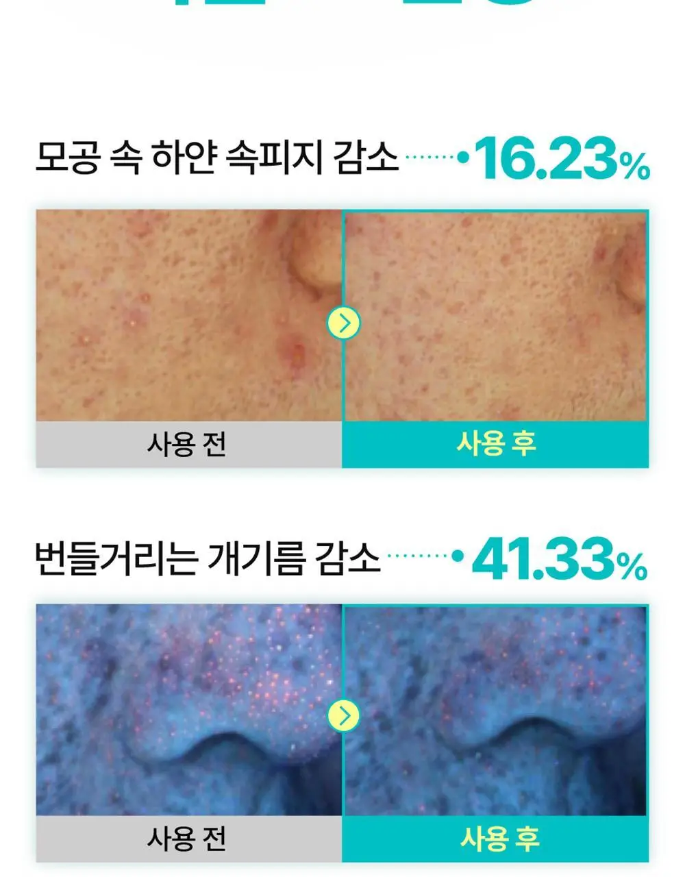 [수분진정][올영단독]넘버즈인 1번 판토텐산 액티브 수딩크림 80ml 1+1 기획 상세페이지 22